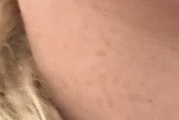 Nacktbilder Amateur Xxleo-ailuxX