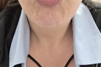 Nacktbilder Amateur DommeX